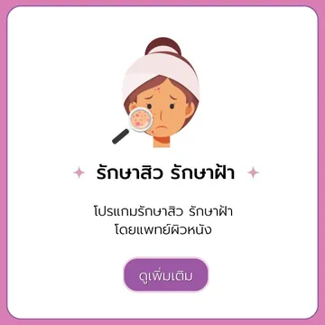 รักษาสิว