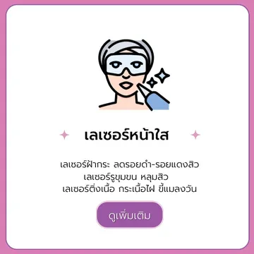 เลเซอร์