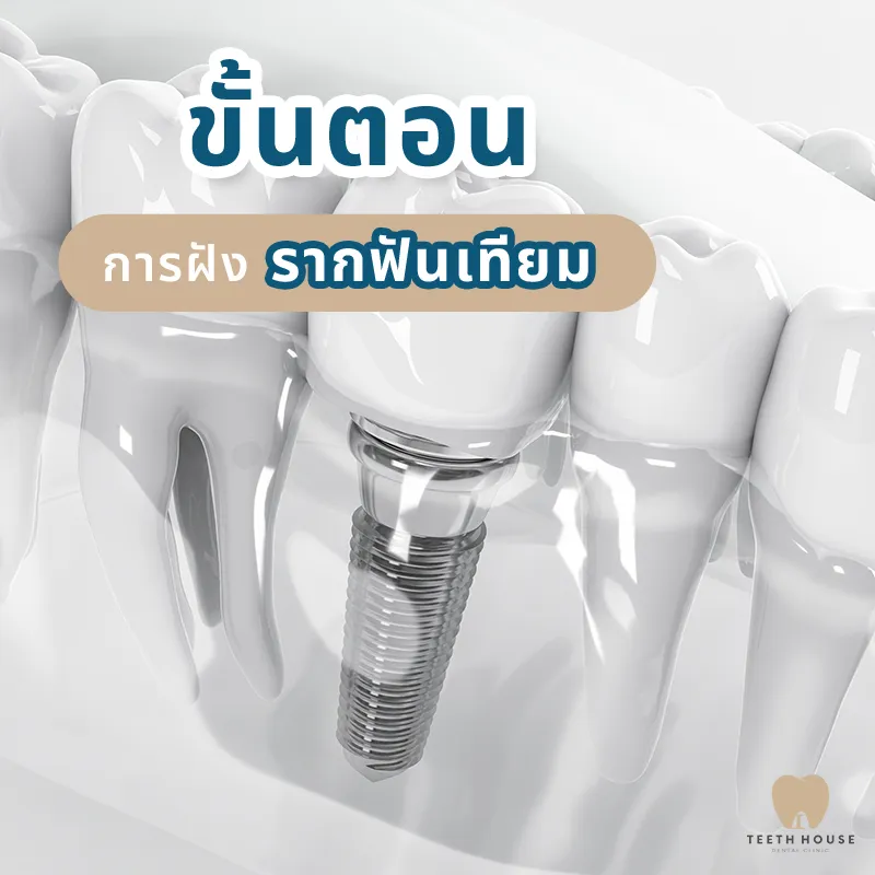 บทความของเรา3