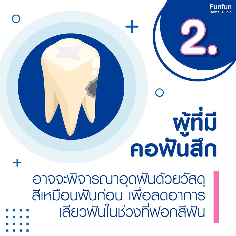 ก่อนฟอกสีฟัน3