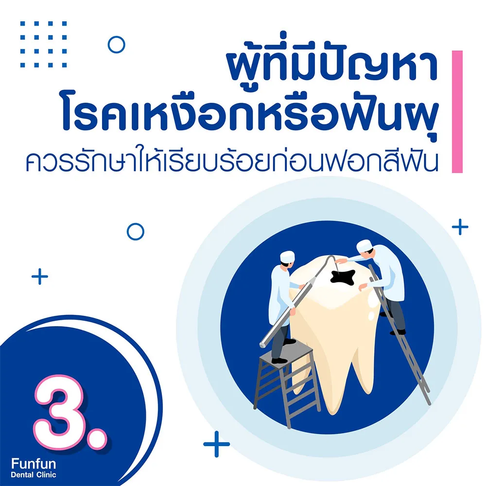 ก่อนฟอกสีฟัน4