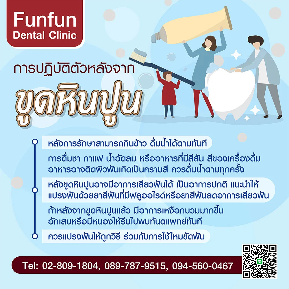 ข้อดีของการขูดหินปูน1