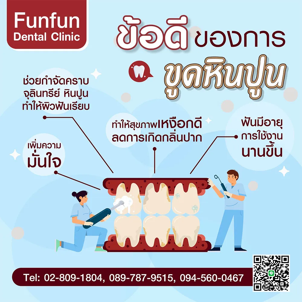 ข้อดีของการขูดหินปูน2