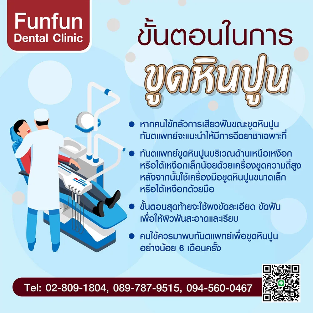 ข้อดีของการขูดหินปูน3