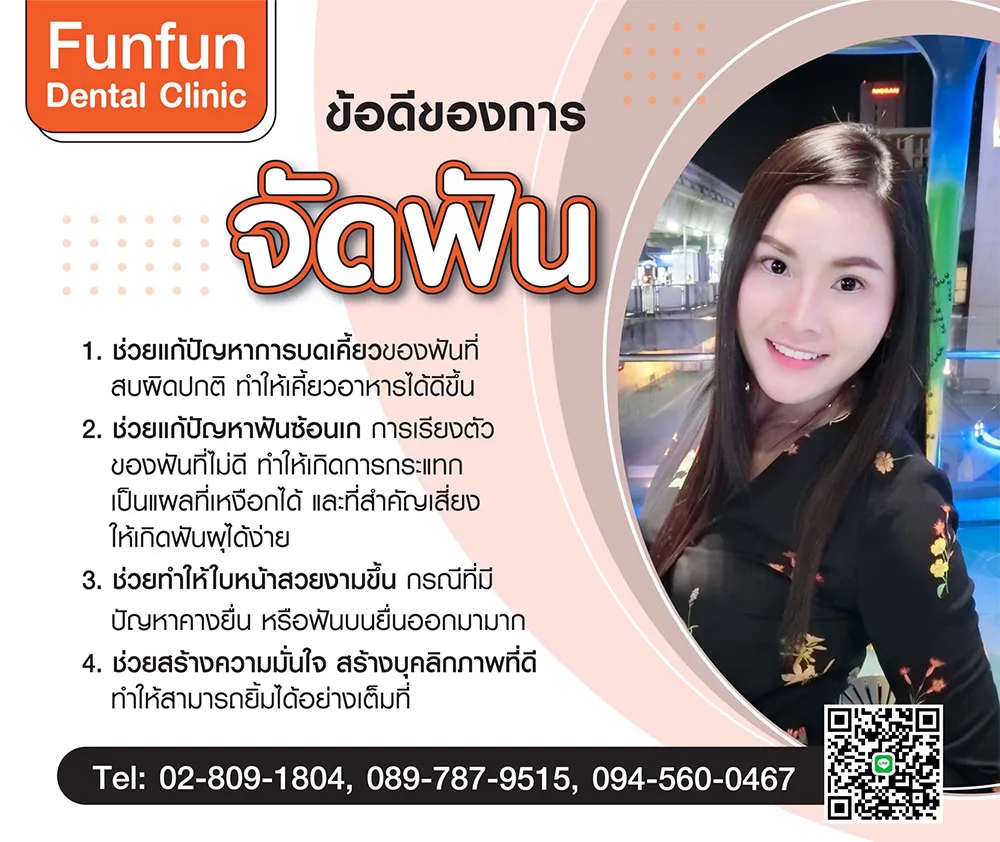 ข้อดีของการจัดฟัน1