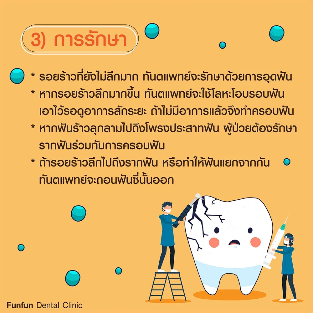 ฟันร้าว2