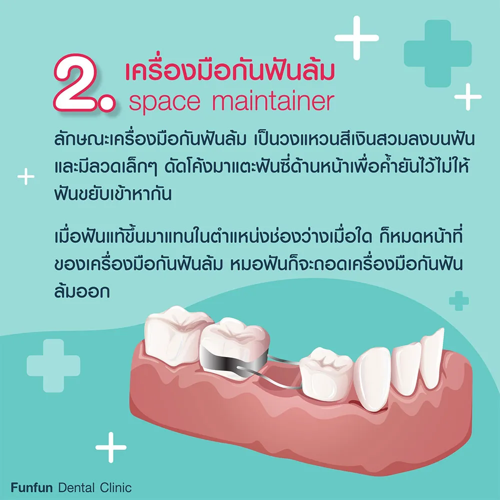 ฟันล้ม3