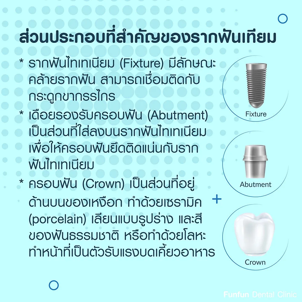 รากฟันเทียม3