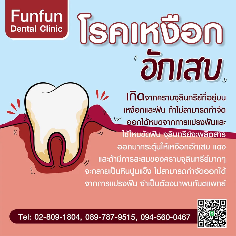 โรคเหงือกอักเสบ