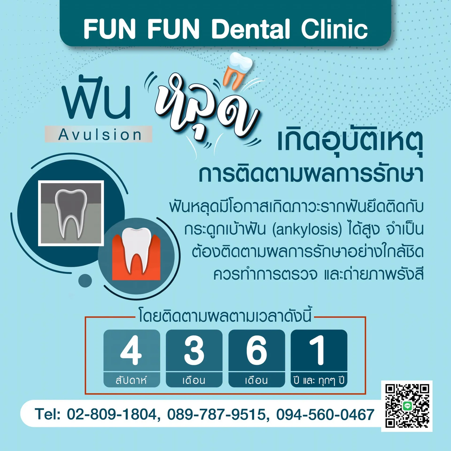 ฟันหลุด4