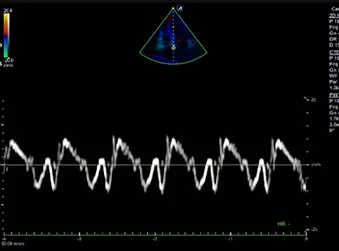 prdultraxc50diagnosisimg02