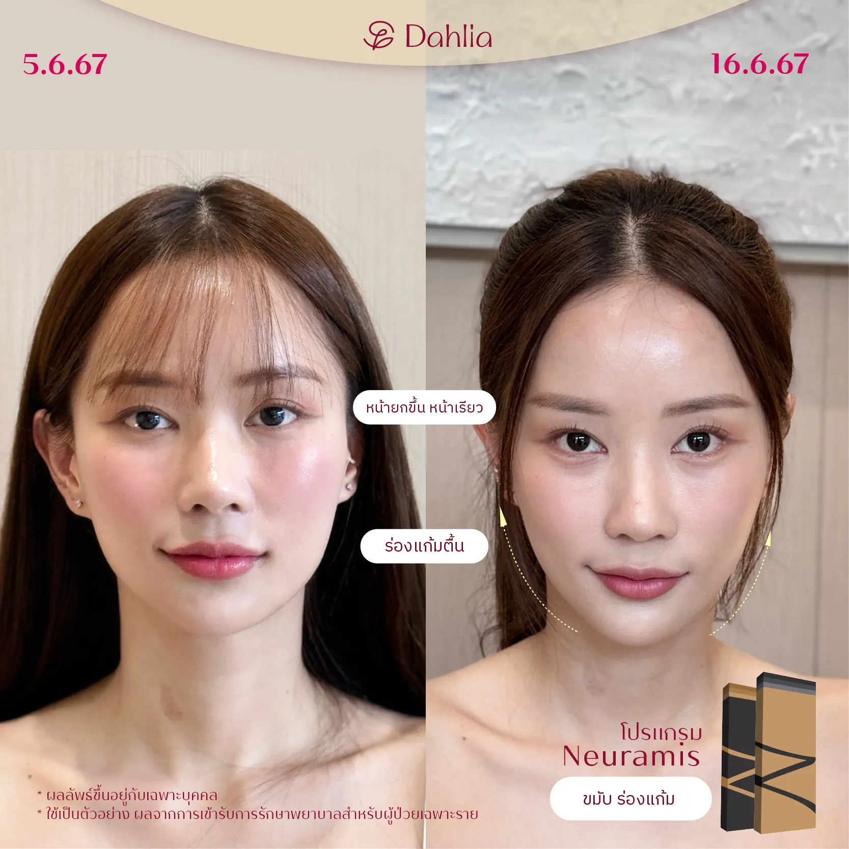 before-after-06
