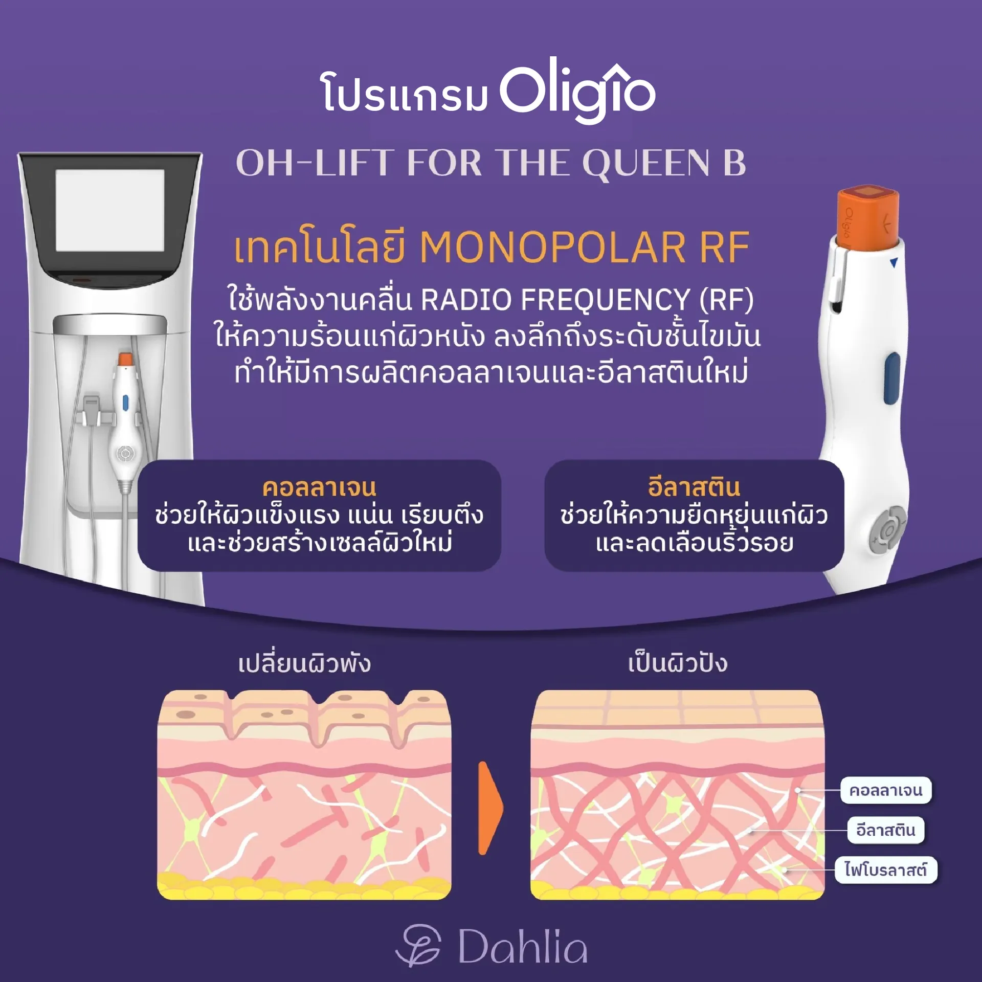 oligio-สบส-02
