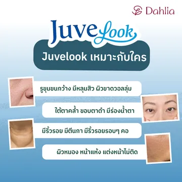 ข้อมูลjuvelook-03