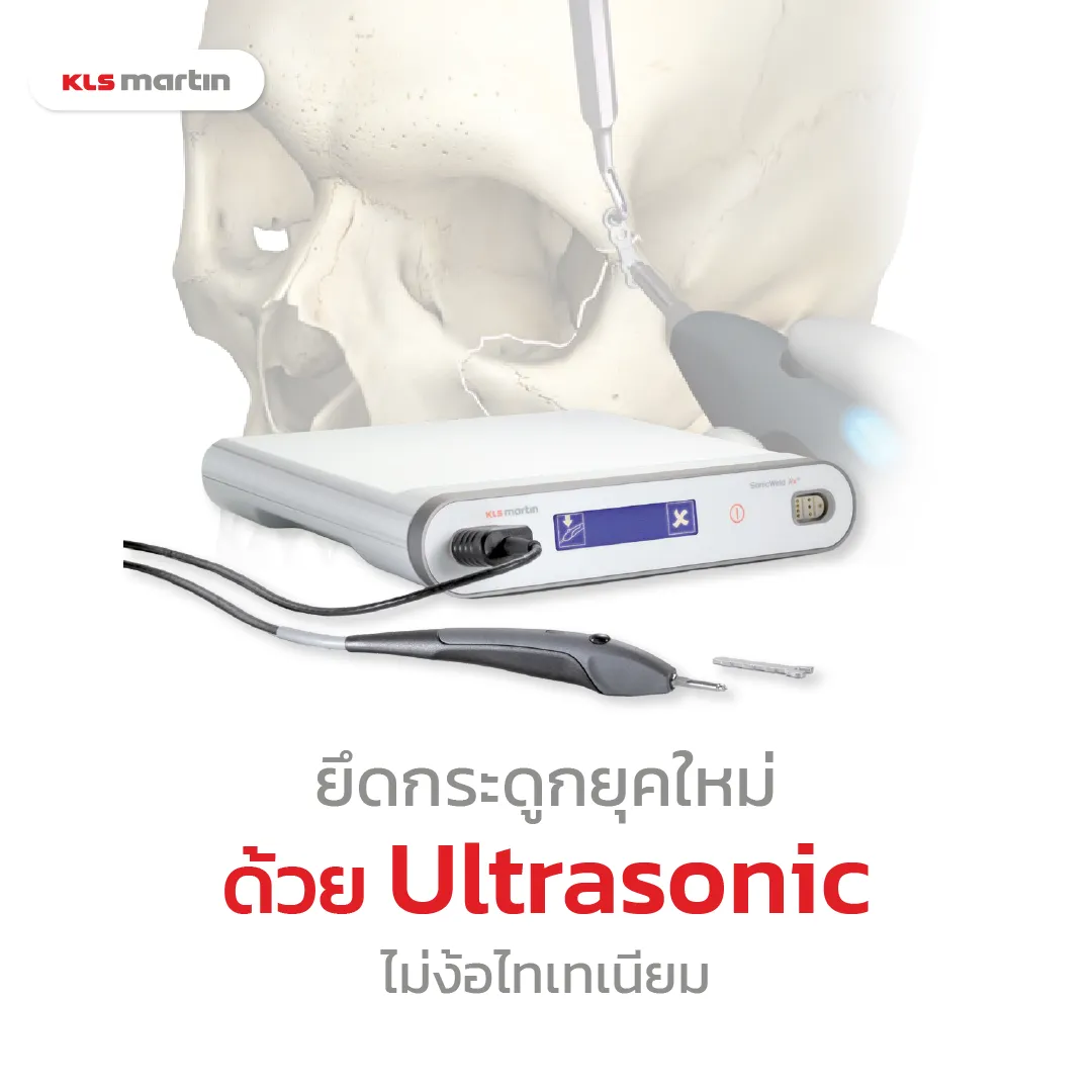ยึดกระดูกด้วยคลื่นUltrasonic-KLSMartin