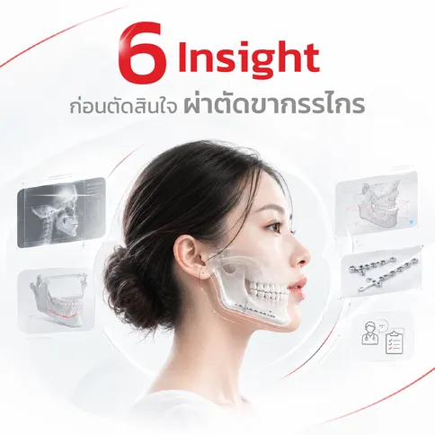6 ข้อควรรู้ ก่อนตัดผ่าตัดขากรรไกร-KLS Martin