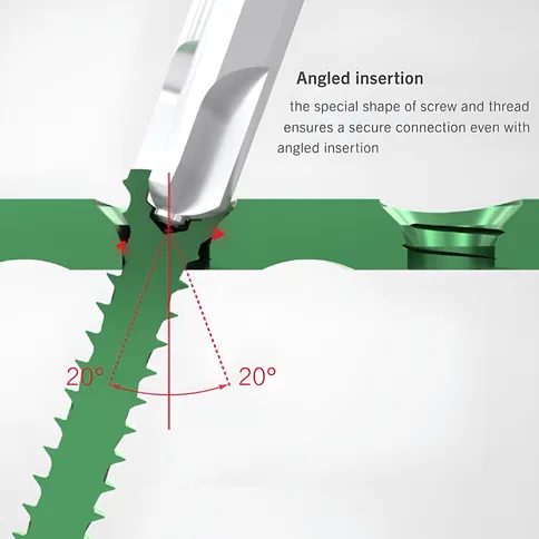 Locking plate & screwsAngled Insertion - KLS Martin