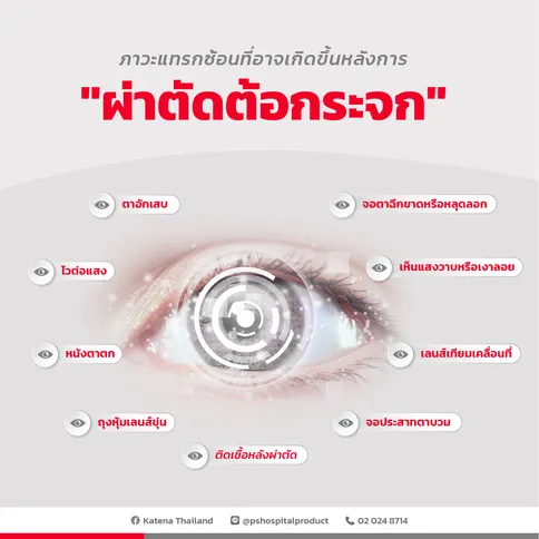 ภาวะแทรกซ้อนที่อาจเกิดขึ้นหลังการผ่าตัดต้อกระจก-02-03