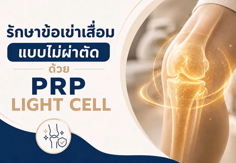 รักษาข้อเข่าเสื่อมแบ