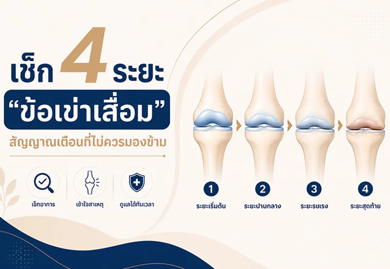เช็ก4ระยะข้อเข