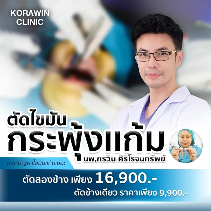 ตัดไขมันกระพุ้งแก้ม