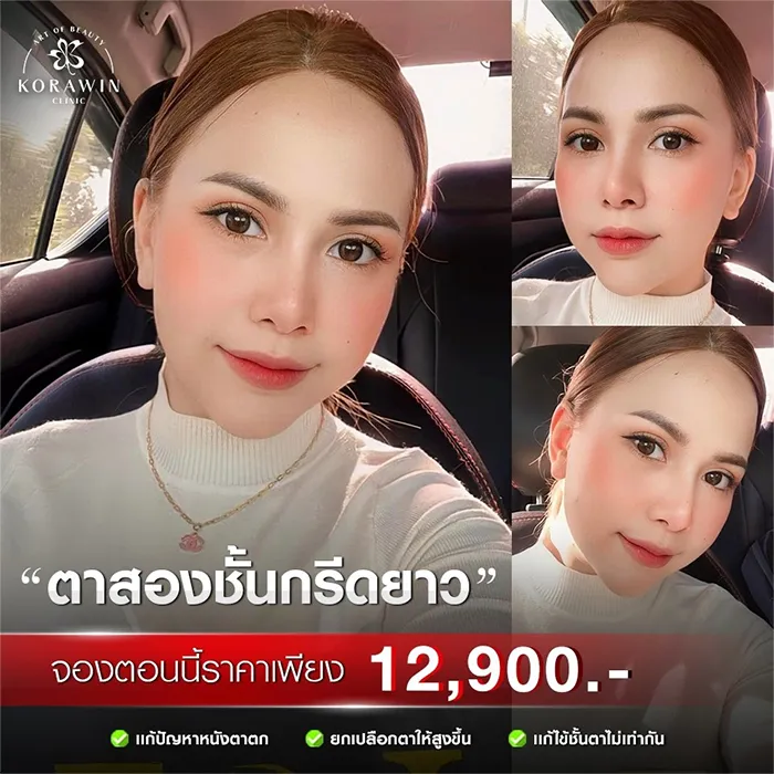 ตาสองชั้นกรีดยาวแผลมินิ