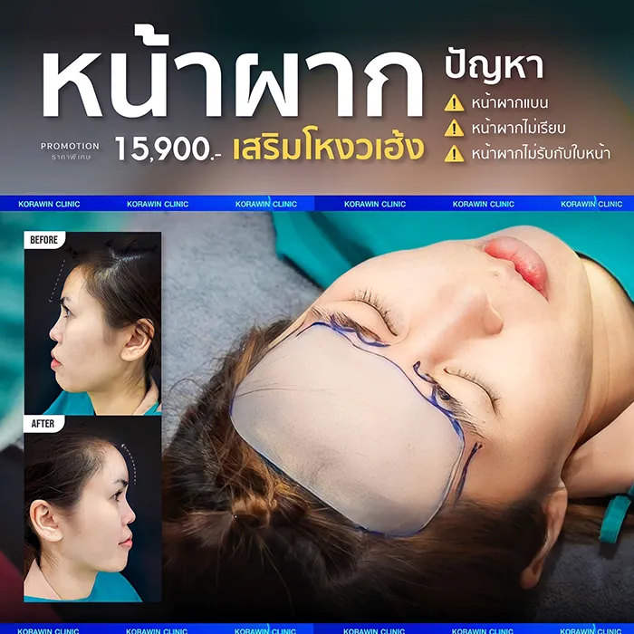 โปรโมชั่น6