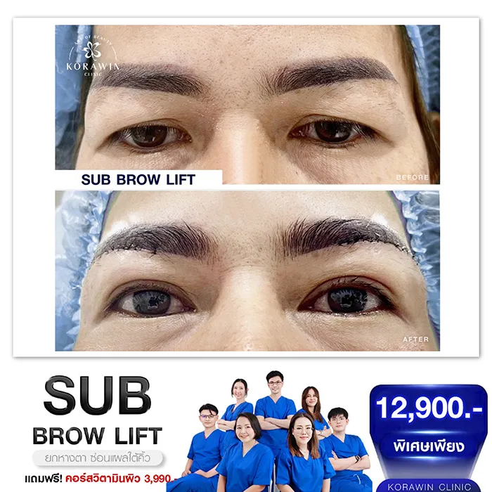 โปรโมชั่น7