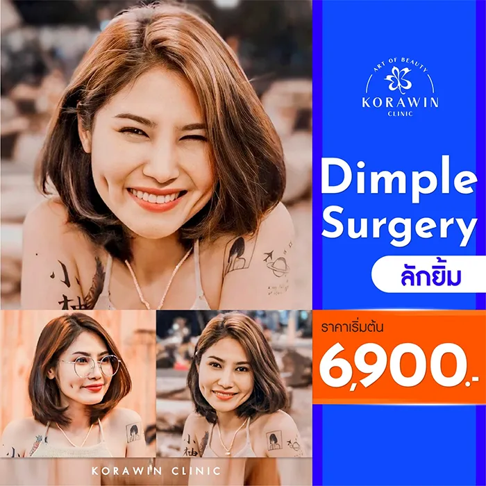 โปรโมชั่น9