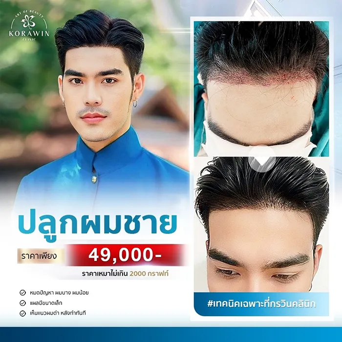 โปรโมชั่น