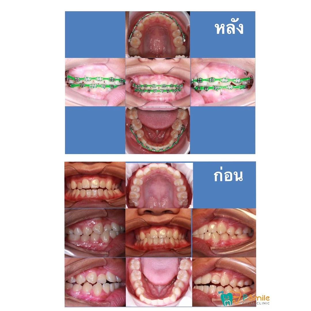 ​รีวิวจากลูกค้า-9