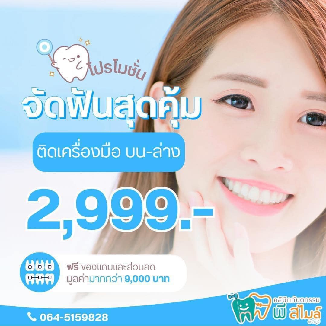 โปรโมชั่นจัดฟันสุดคุ้ม ต้อนรับหน้าฝน