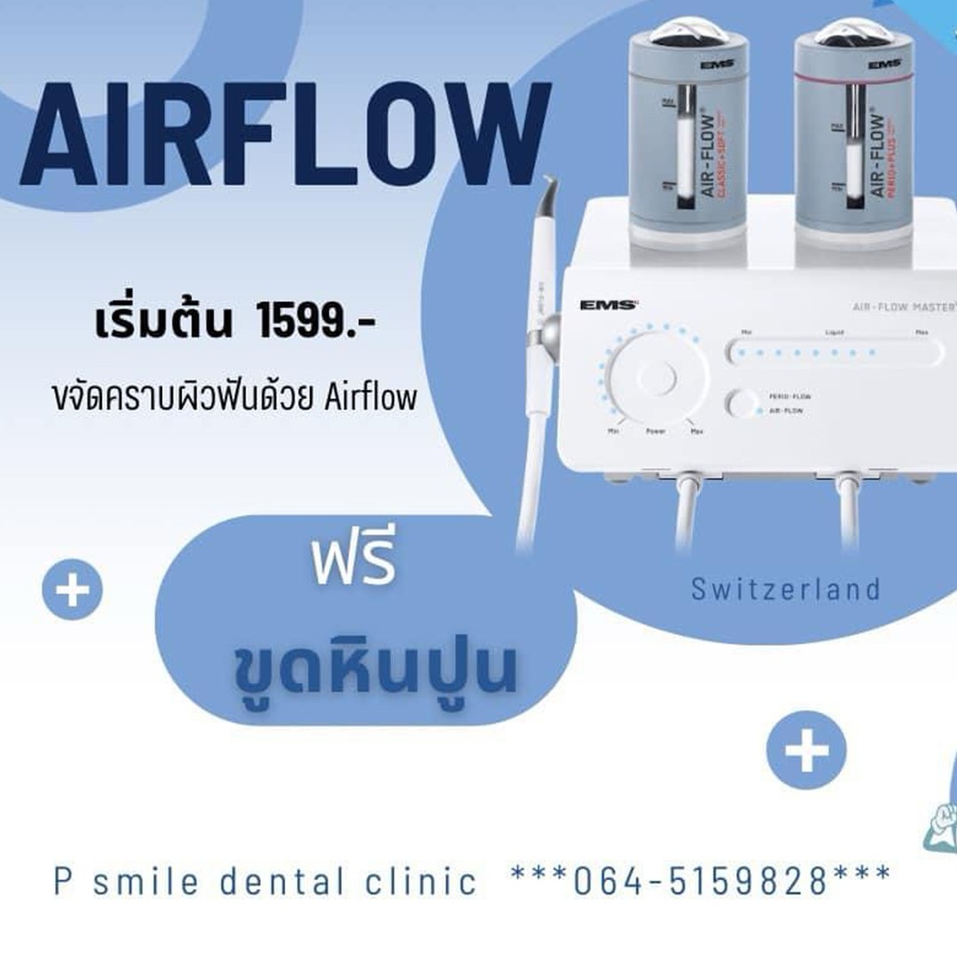 โปรโมชั่นขัดฟันระบบ Air Flow 